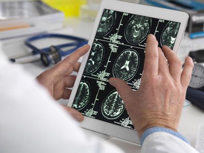 A doctor looking at a brain scan on an ipad